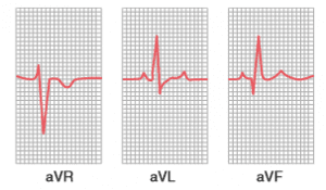 How to measure heart rate from ecg