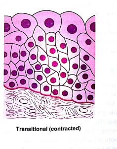 Classification of epithelium - transitional contracted