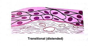 Classification of epithelium -transitional distended