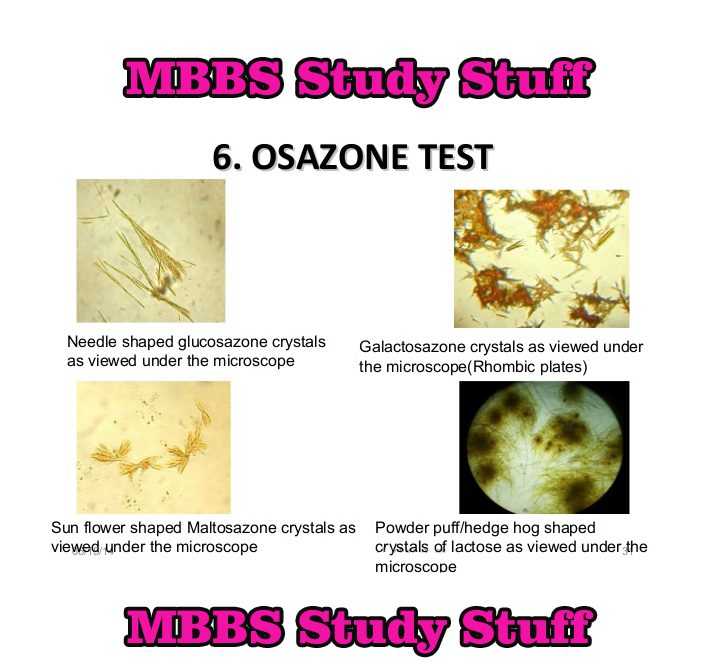 OSAZONE TEST