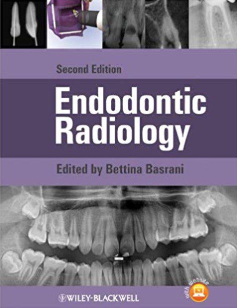 Endodontic Radiology 2nd Edition PDF Free Download