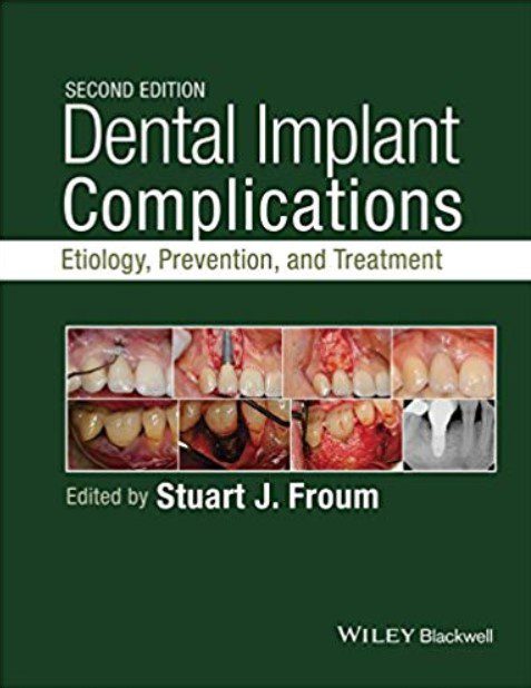 Dental Implant Complications Second Edition PDF Free Download