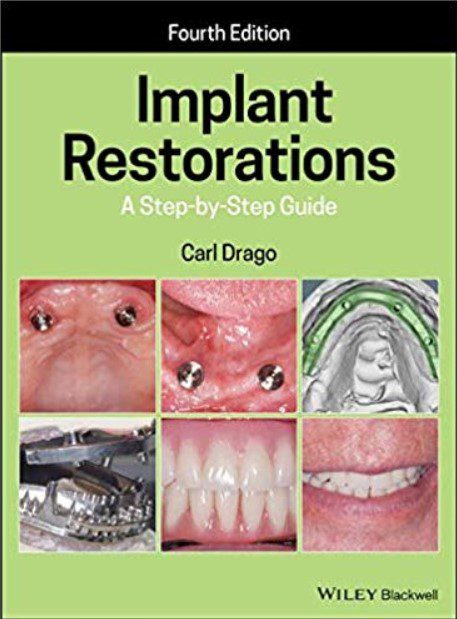 Implant Restorations: A step by step Guide 4th Edition PDF Free Download