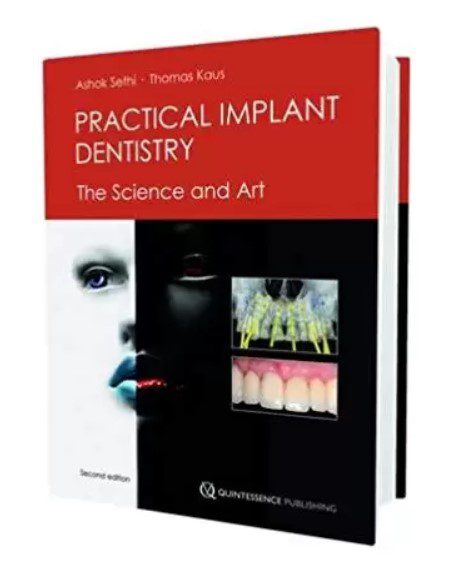 Practical Implant Dentistry: The Science and Art Second Edition PDF Free Download