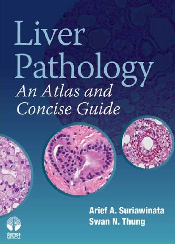 Download Liver Pathology: An Atlas and Concise Guide PDF Free