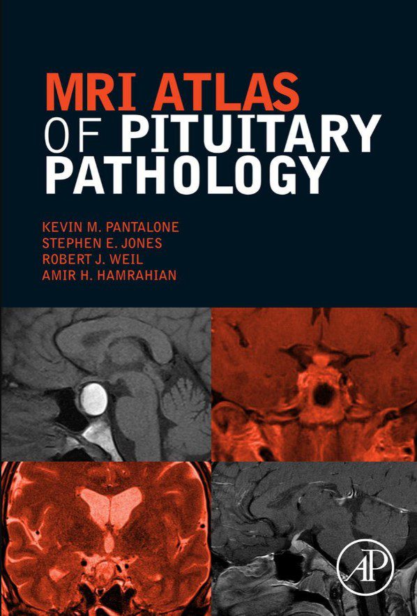 Download MRI Atlas of Pituitary Pathology 1st Edition PDF Free