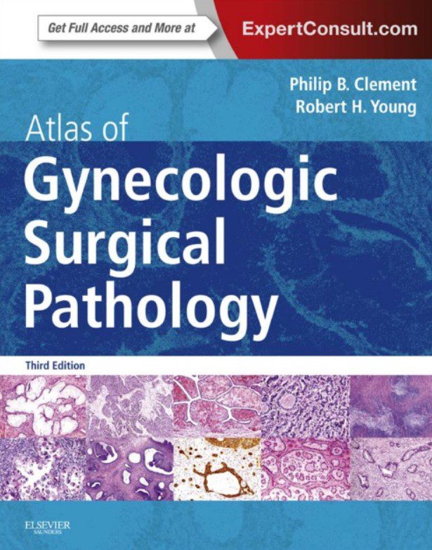Download Atlas of Gynecologic Surgical Pathology 3rd Edition PDF Free