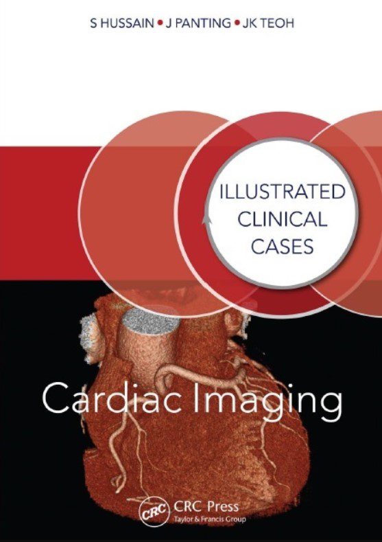 Download Cardiac Imaging: Illustrated Clinical Cases 1st Edition PDF Free