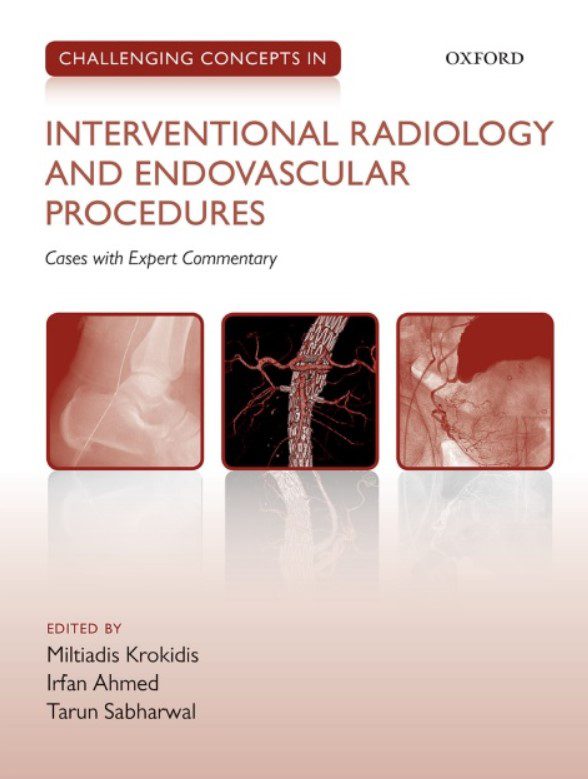 Download Challenging Concepts in INTERVENTIONAL RADIOLOGY 1st Edition PDF Free