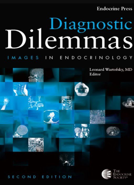 Download Diagnostic Dilemmas: Images In Endocrinology 2nd Edition PDF Free