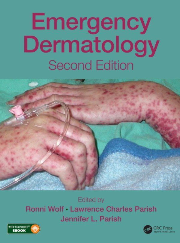 Download Emergency Dermatology 2nd Edition PDF Free