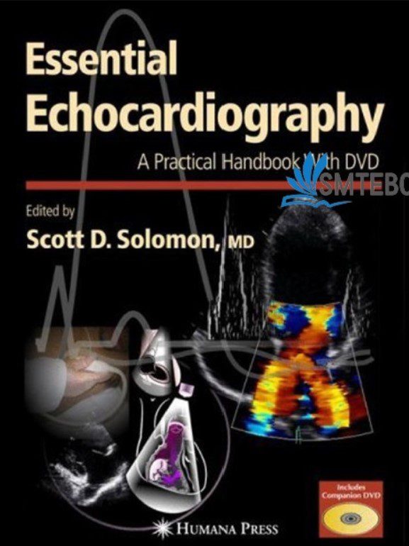 Download Essential Echocardiography: A Practical Guide With DVD by Scott D. Solomon PDF Free