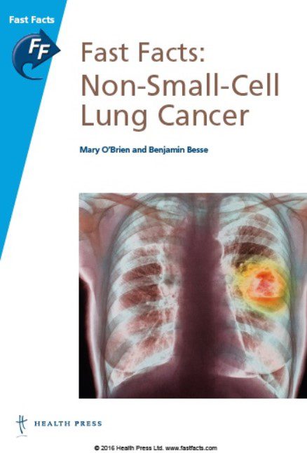 Download Fast Facts: Non-Small-Cell Lung Cancer PDF Free