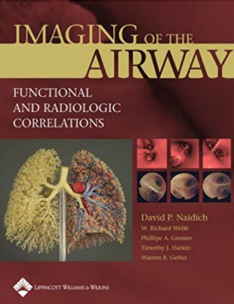 Download Imaging of the Airways: Functional and Radiologic Correlations PDF Free