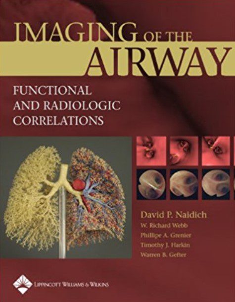 Download Imaging of the Airways: Functional and Radiologic Correlations PDF Free