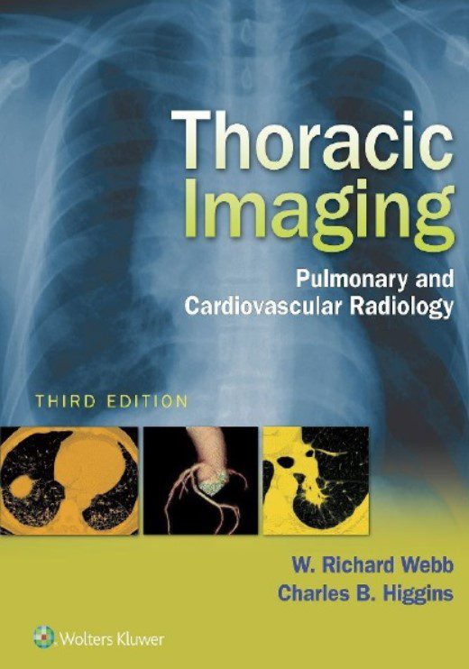 Download Thoracic Imaging: Pulmonary and Cardiovascular Radiology 3rd Edition PDF Free
