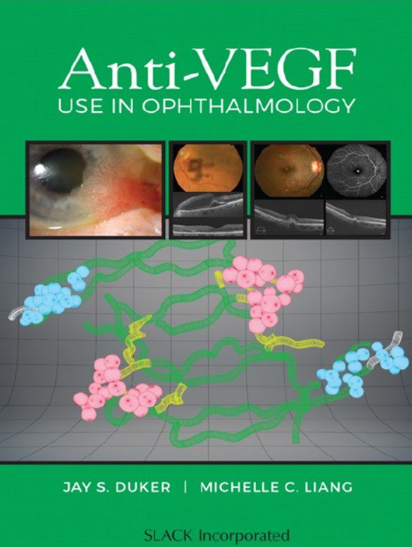Download Anti-VEGF Use in Ophthalmology PDF Free