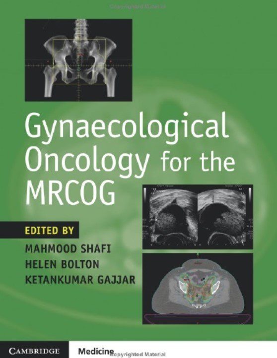 Download Gynaecological Oncology for the MRCOG PDF Free