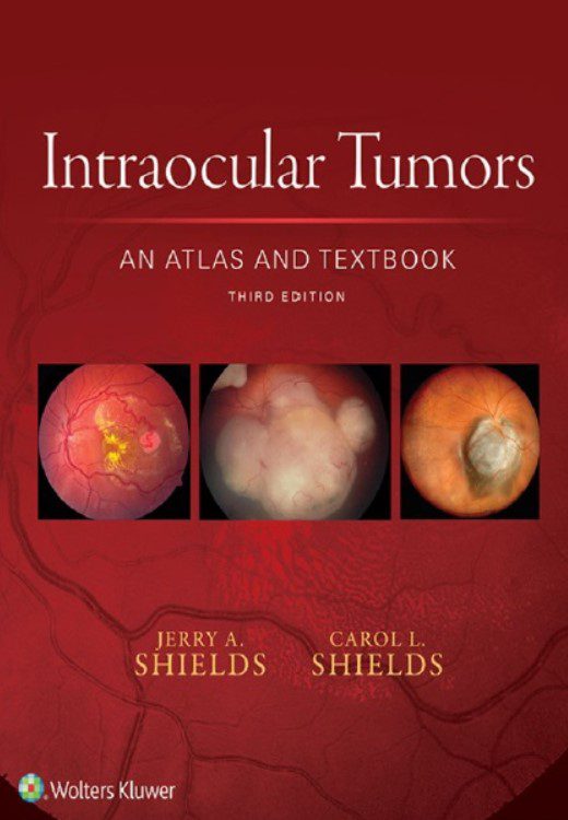 Download Intraocular Tumors: An Atlas and Textbook Third Edition PDF Free