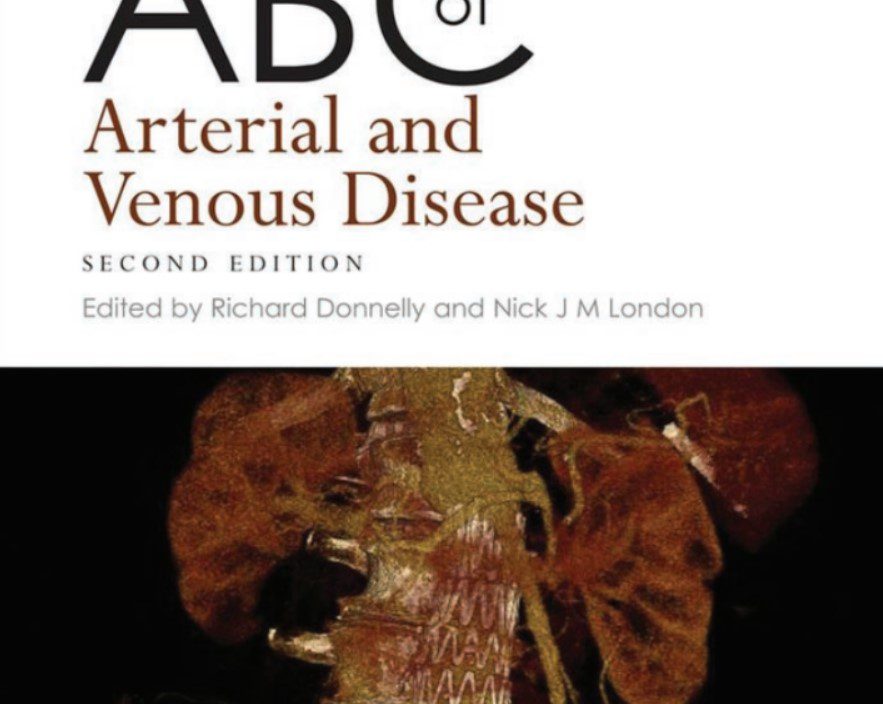 ABC of Arterial and Venous Disease 2nd Edition PDF Free Download