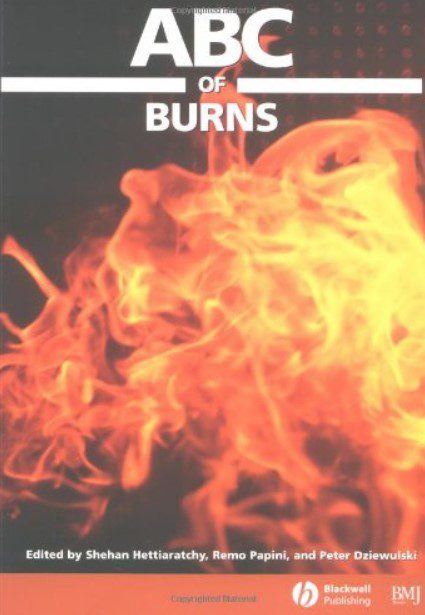 ABC of Burns PDF Free Download