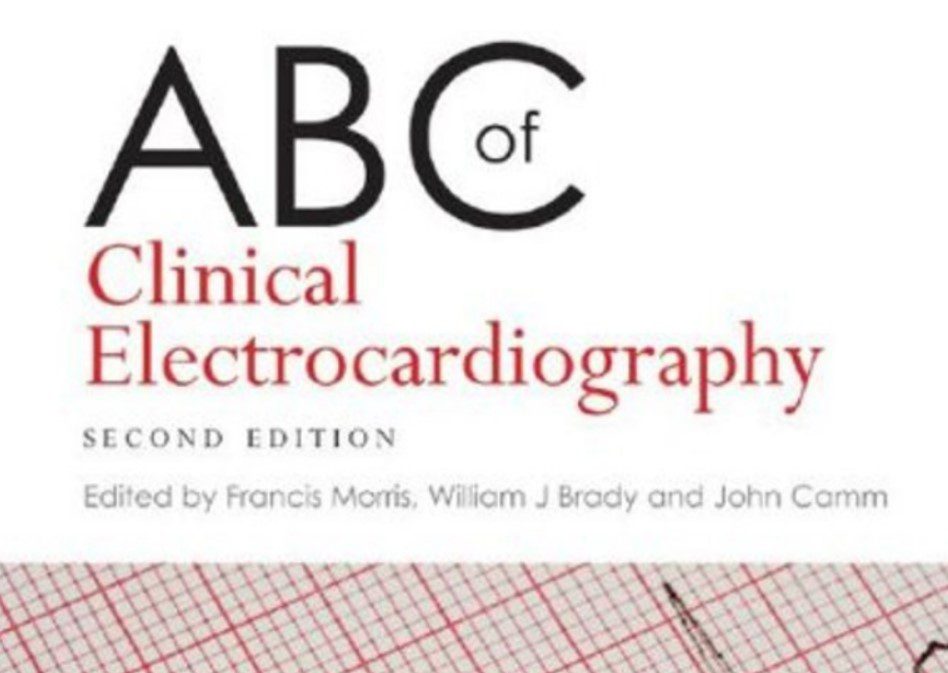 ABC of Clinical Electrocardiography 2nd Edition PDF Free Download