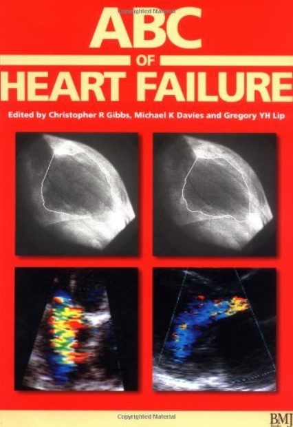 ABC of Heart Failure PDF Free Download