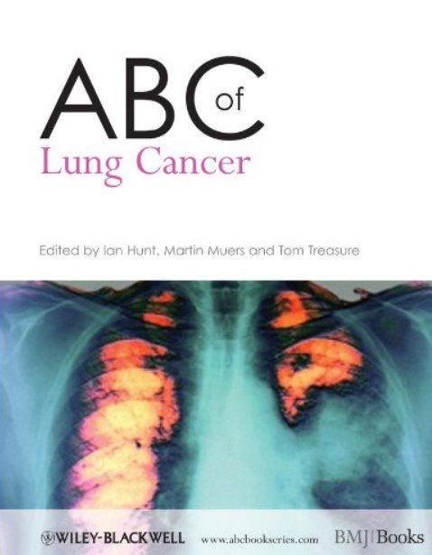 ABC of Lung Cancer PDF Free Download