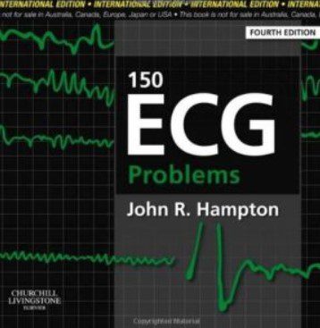 150 ECG problems 4th Edition PDF Free Download