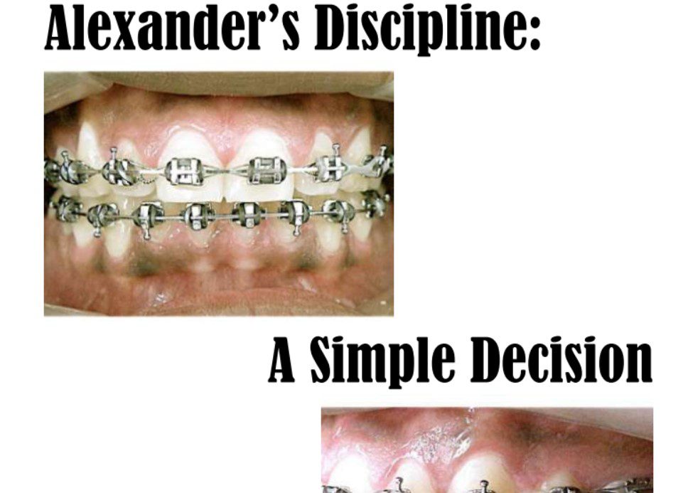 Alexanders Discipline A Simple Decision PDF Free Download