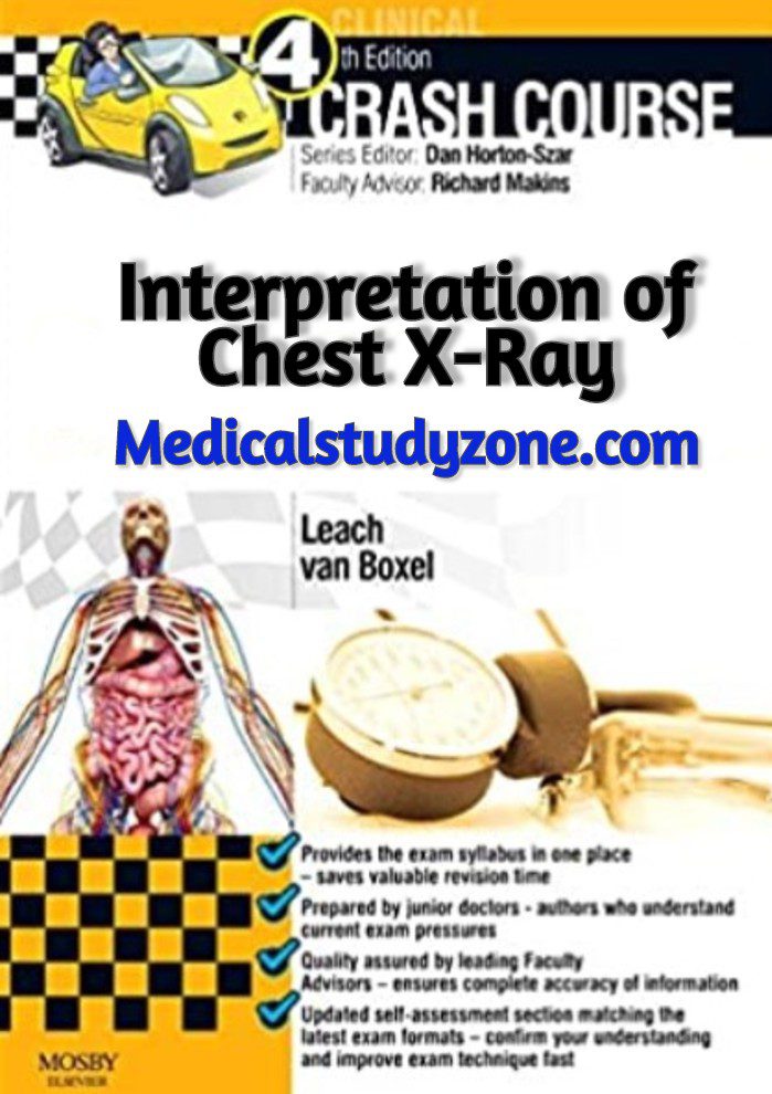 Crash Course Interpretation of Chest X-Ray PDF Free Download