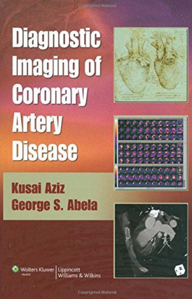 Diagnostic Imaging of Coronary Artery Disease CHM PDF Free Download