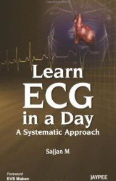 Learn ECG in a Day PDF Free Download