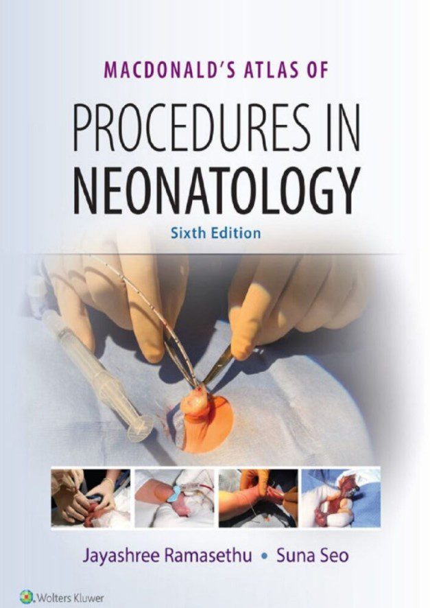 MacDonald’s Atlas Of Procedures In Neonatology 6th Edition PDF Free Download