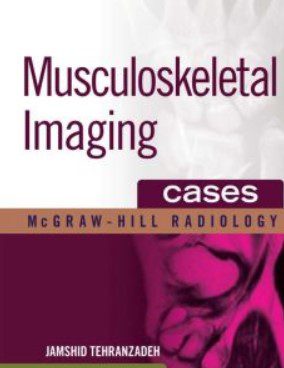 Musculoskeletal Imaging Cases PDF Free Download
