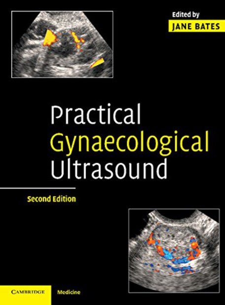 Practical Gynaecological Ultrasound 2nd Edition PDF Free Download