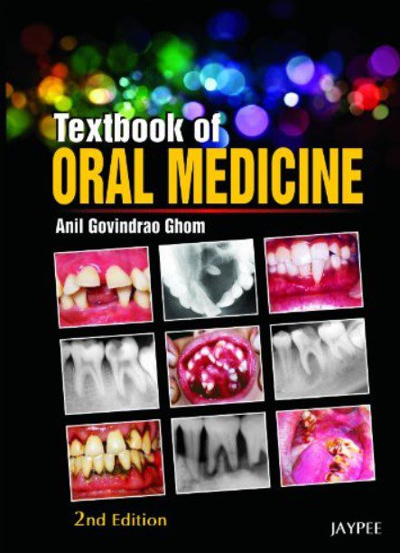 Textbook of Oral Medicine 2nd Edition PDF Free Download