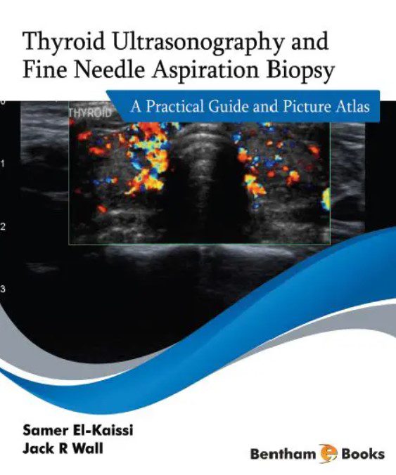 Thyroid Ultrasonography and Fine Needle Aspiration Biopsy PDF Free Download