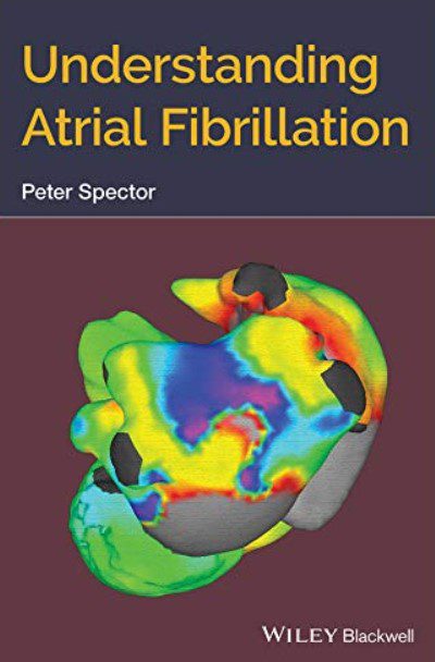 Understanding Atrial Fibrillation PDF Free Download