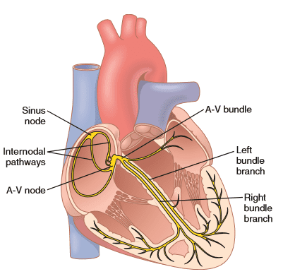 Heart Block And Its Types