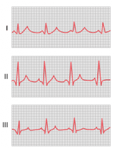 How to measure heart rate from ecg