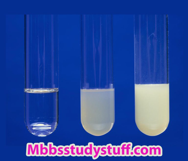 Protein Precipitation tests Medical Study Zone