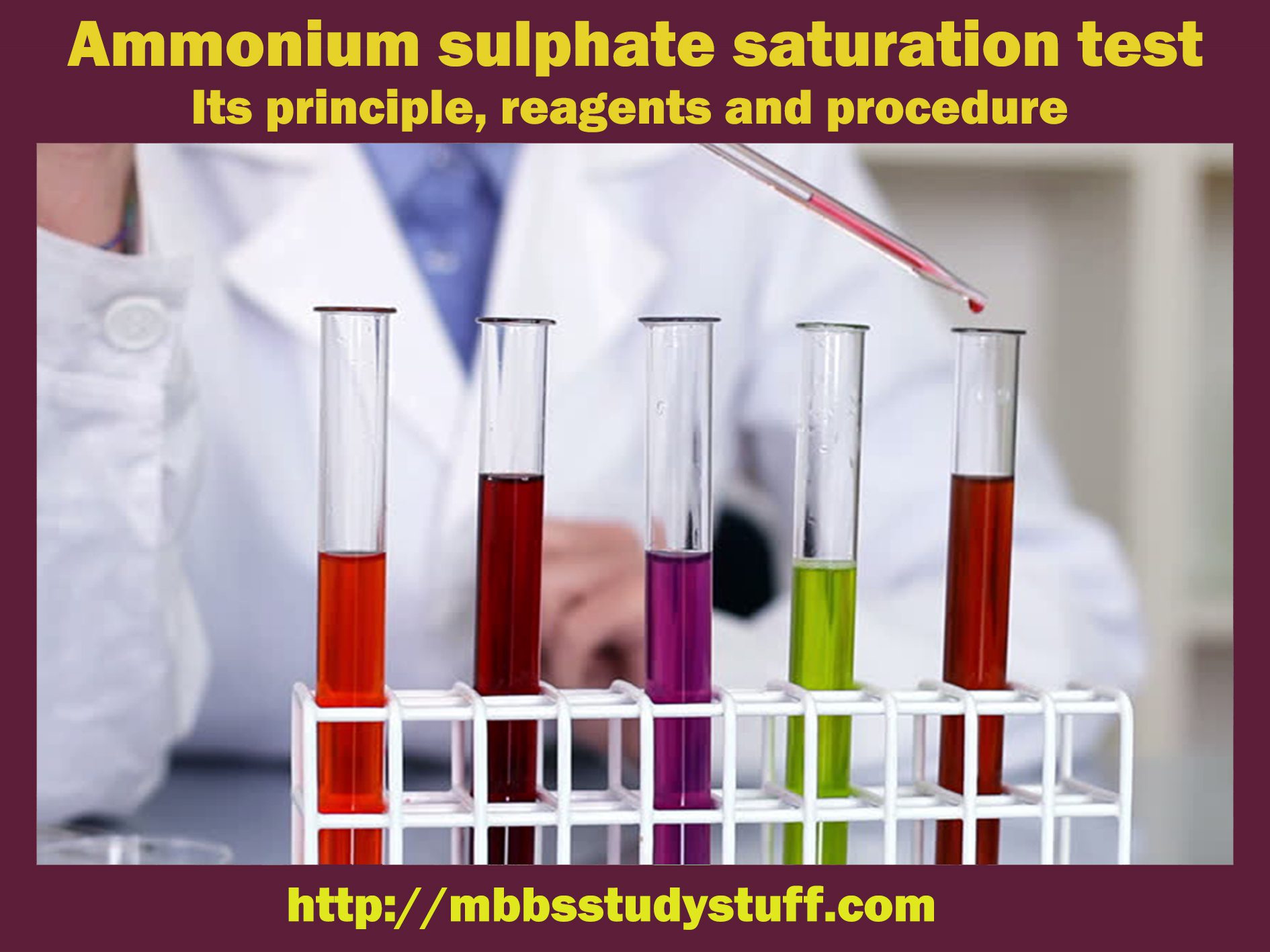 Ammonium sulphate saturation test - Its principle, reagents and procedure