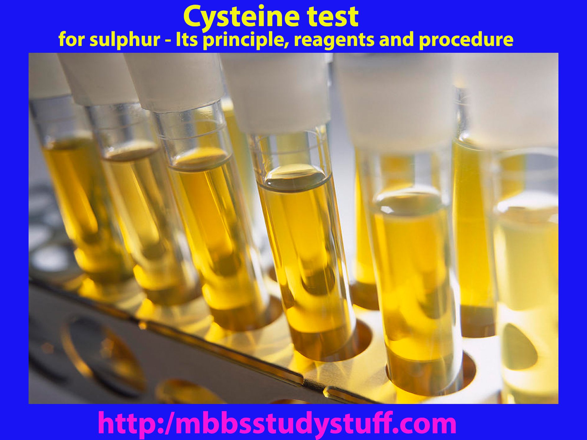 Cysteine test for sulphur