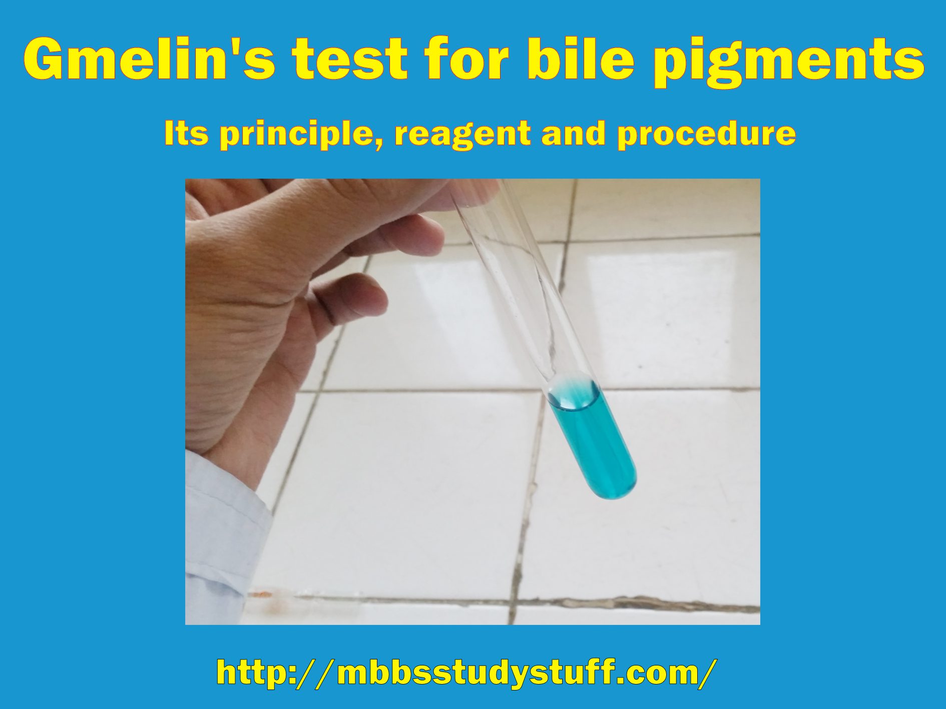 Gmelin's test for bile pigments - Its principle, reagent and procedure
