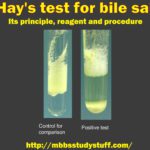Hay's test for bile salts