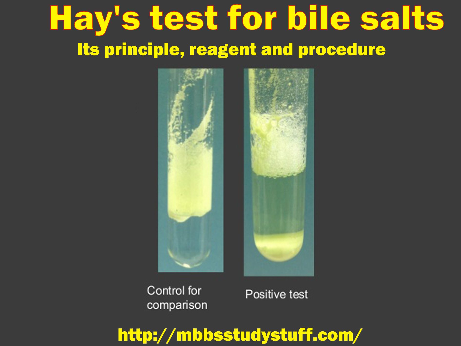 Hay's test for bile salts - Its principle, reagent and procedure