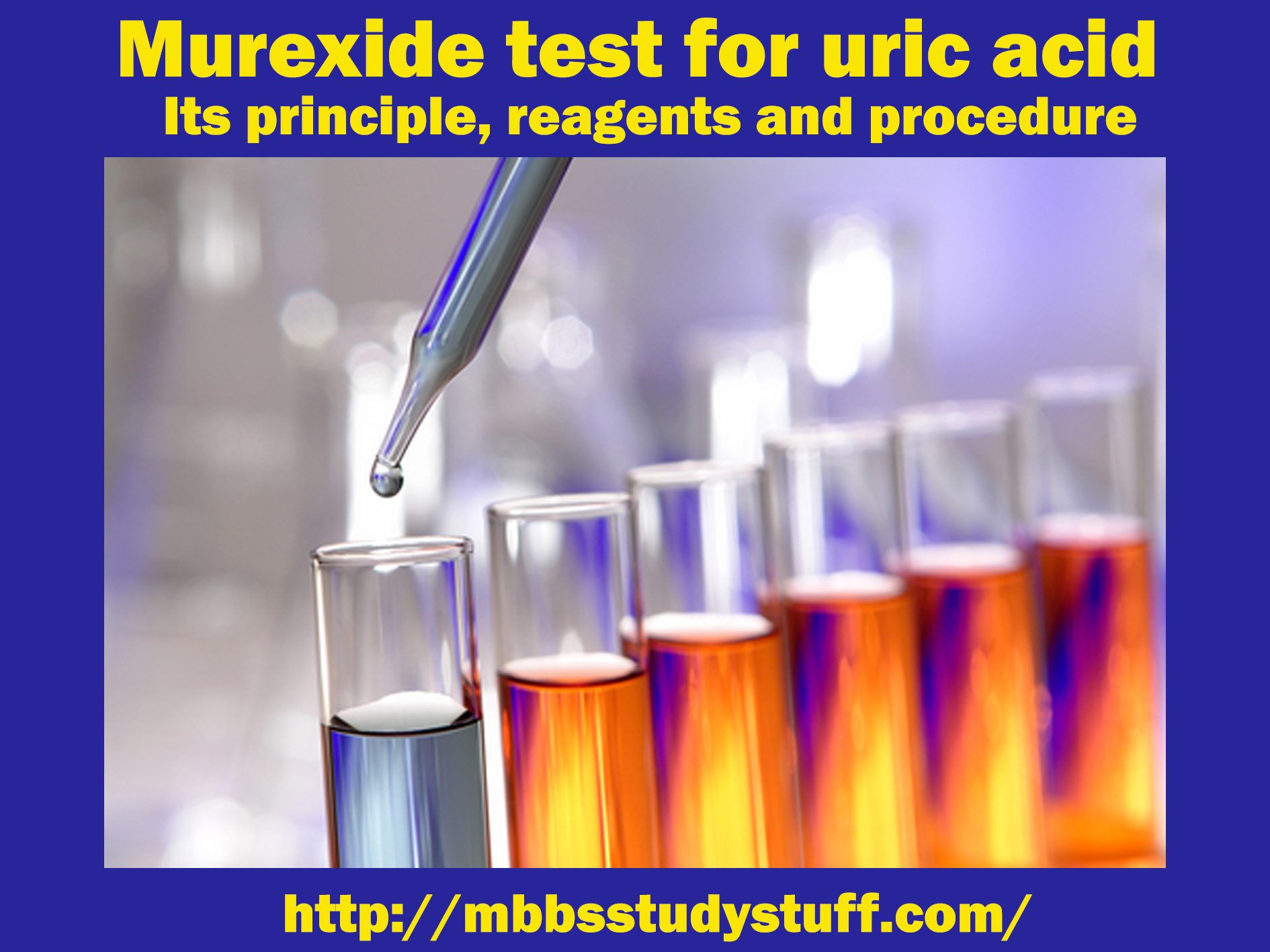 Murexide test for uric acid - Its principle, reagents and procedure