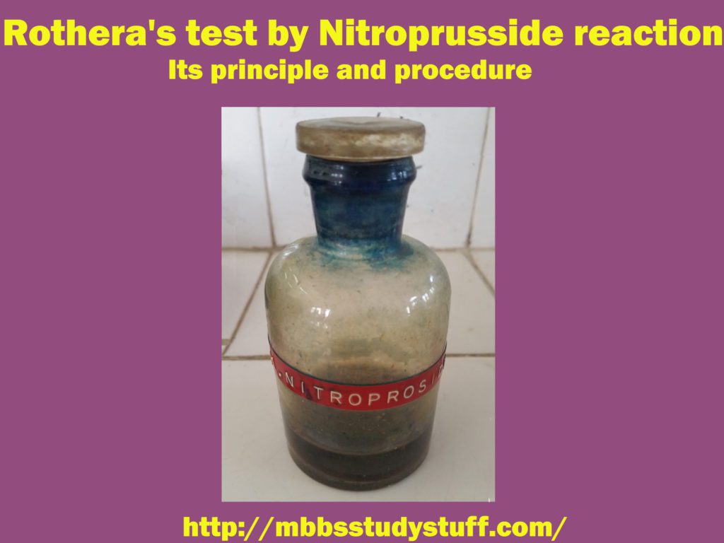 Rothera's test by Nitroprusside reaction
