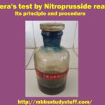 Rothera's test by Nitroprusside reaction